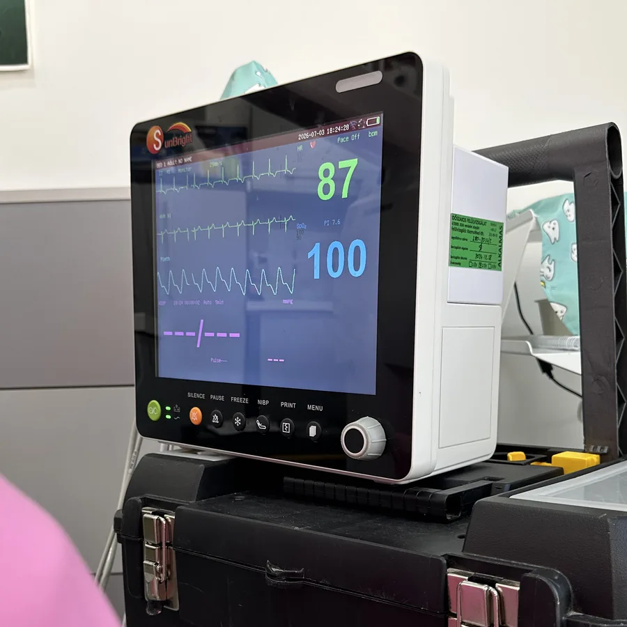 Betegőrző monitor a kezelőben, a pulzus és az oxigénszaturáció folyamatos figyelésére